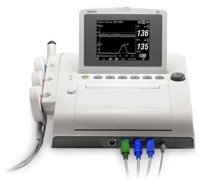 Monitor fetal: Edan / F2