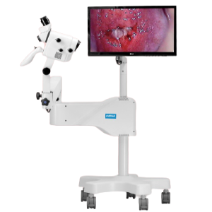 Video Colposcopio: Zumax – CLS3080